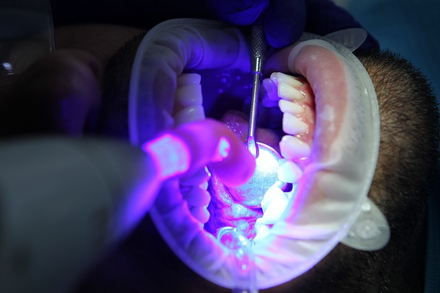 Zářivě bílé zuby můžete mít i vy
